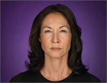 Image related to Botox for Tacoma Washington