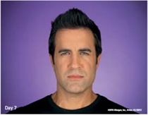 Image related to Botox for Tacoma Washington